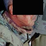 Militar herido