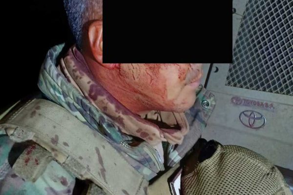 Militar herido