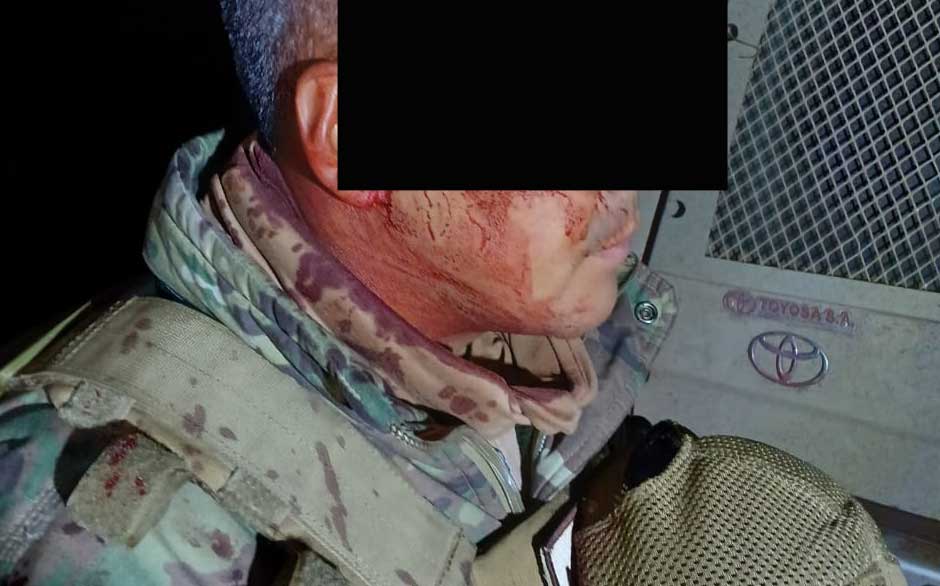Militar herido